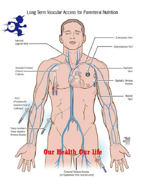 Enteral Parenteral nutrition