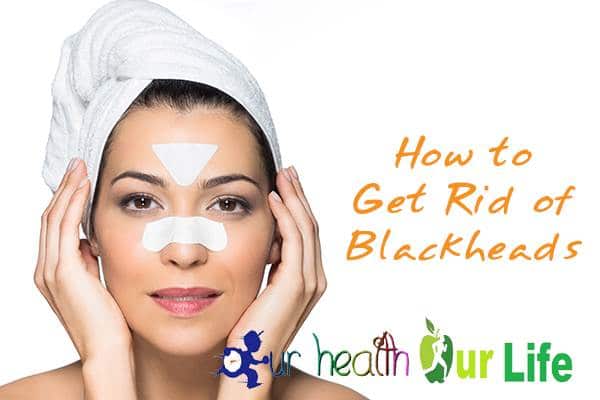 Tips to Get Rid of Blackheads