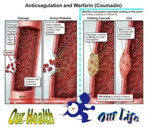 anticoagulated