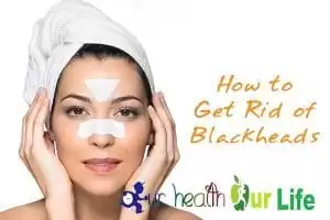 13 Tips to Get Rid of Blackheads