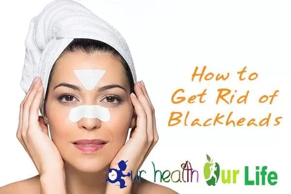 Tips to Get Rid of Blackheads
